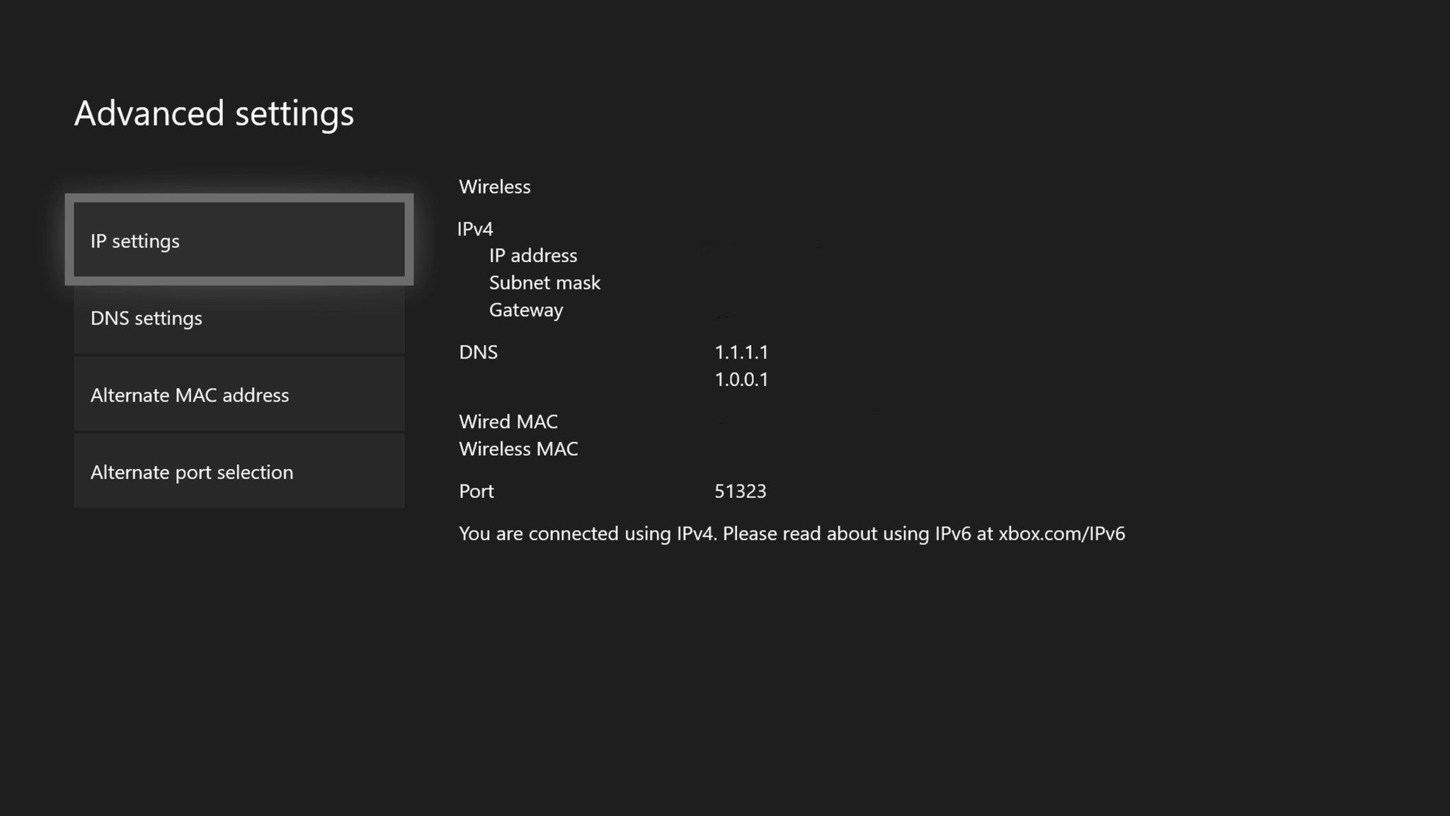 How To Find Your Xbox One IP Address