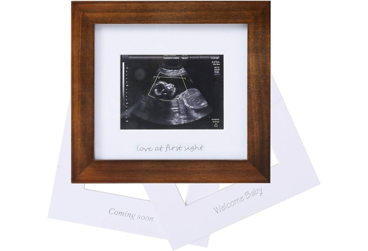 10 Incredible Sonogram Picture Frame for 2024
