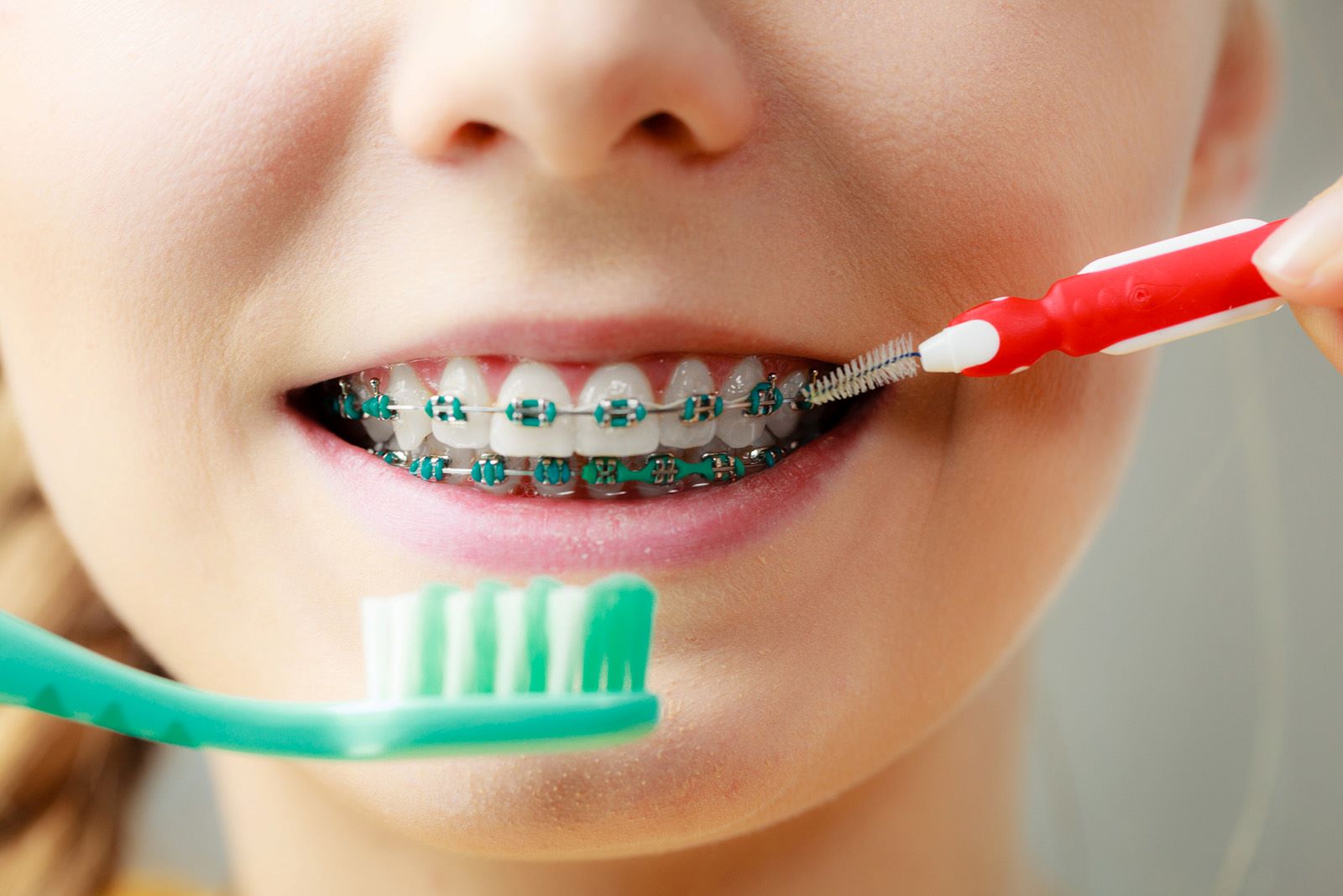 how-do-you-brush-your-teeth-with-braces