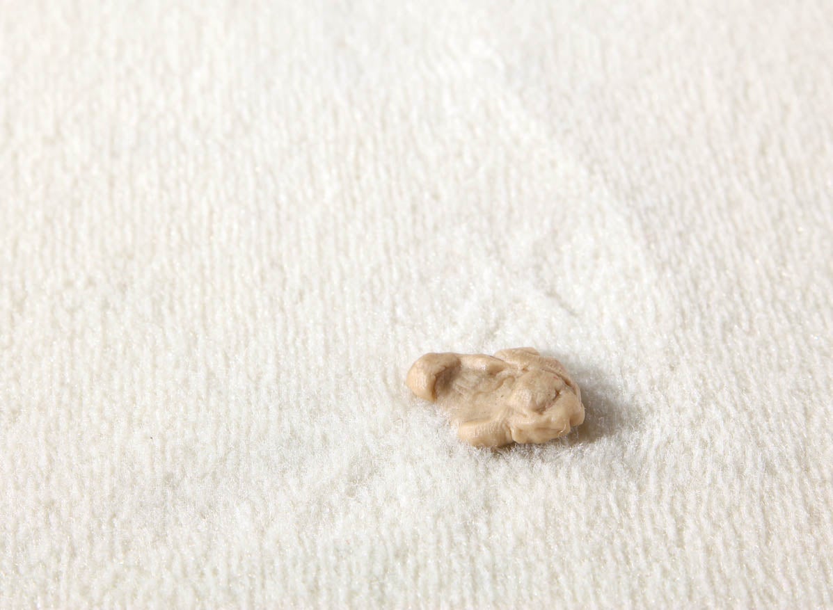 how-to-remove-gum-from-rug