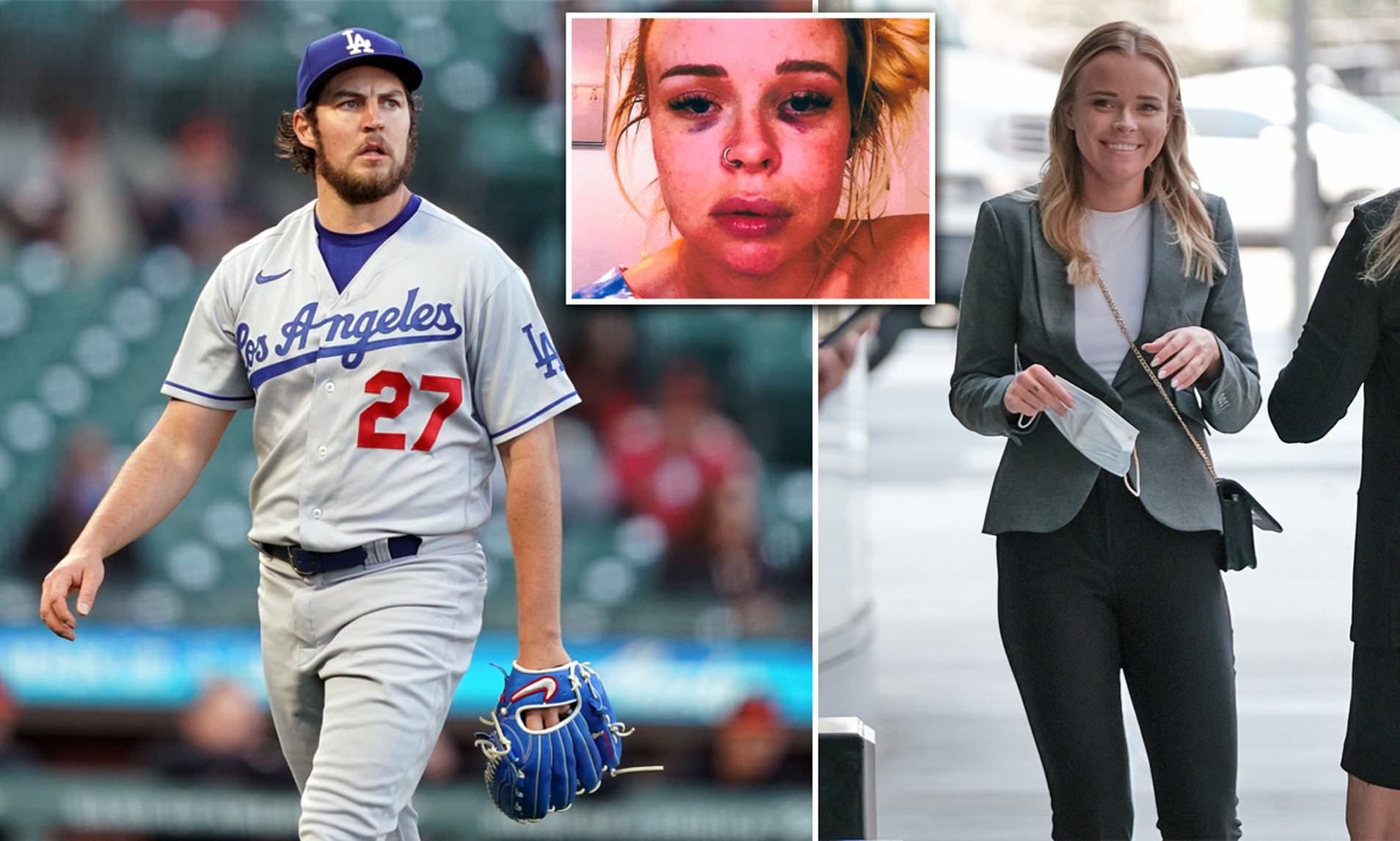 trevor-bauer-lindsey-hill-agree-to-settle-lawsuits-with-each-other