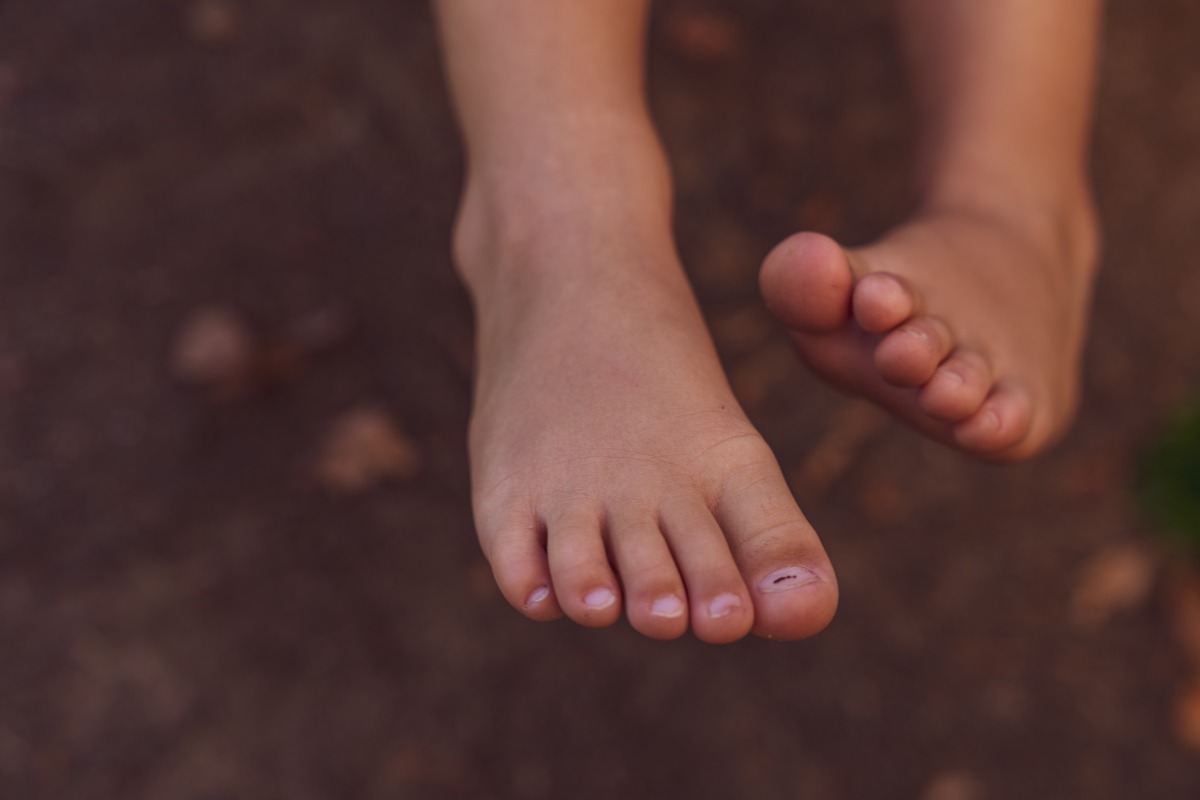 What Essential Oil Is Good For Toe Fungus
