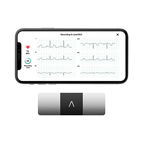 KardiaMobile 6-Lead EKG Monitor