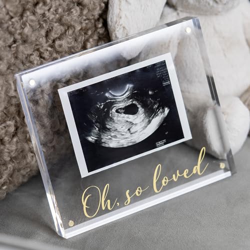 Ultrasound Picture Frames
