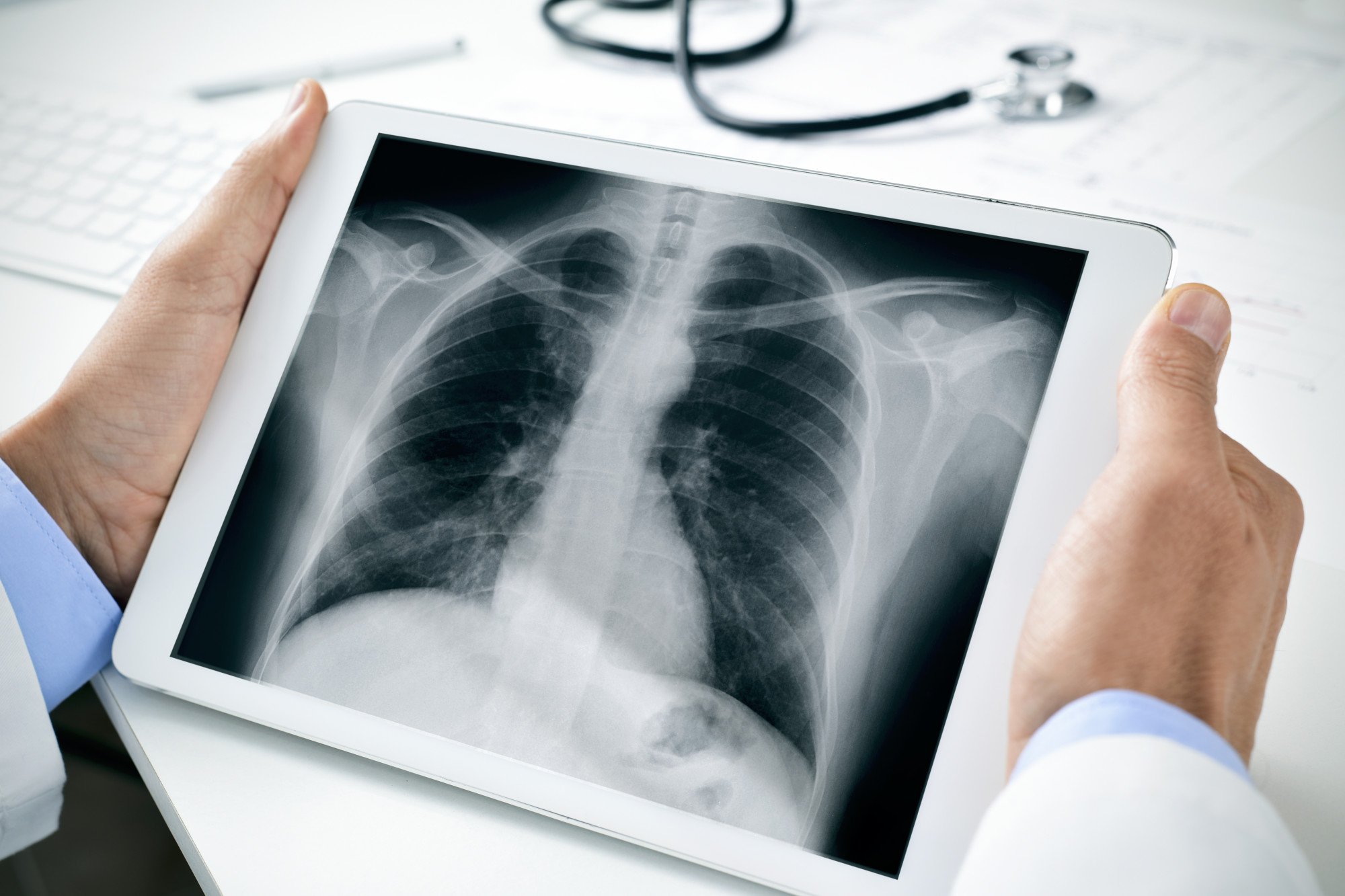 what-are-three-advantages-of-digital-x-rays-over-film