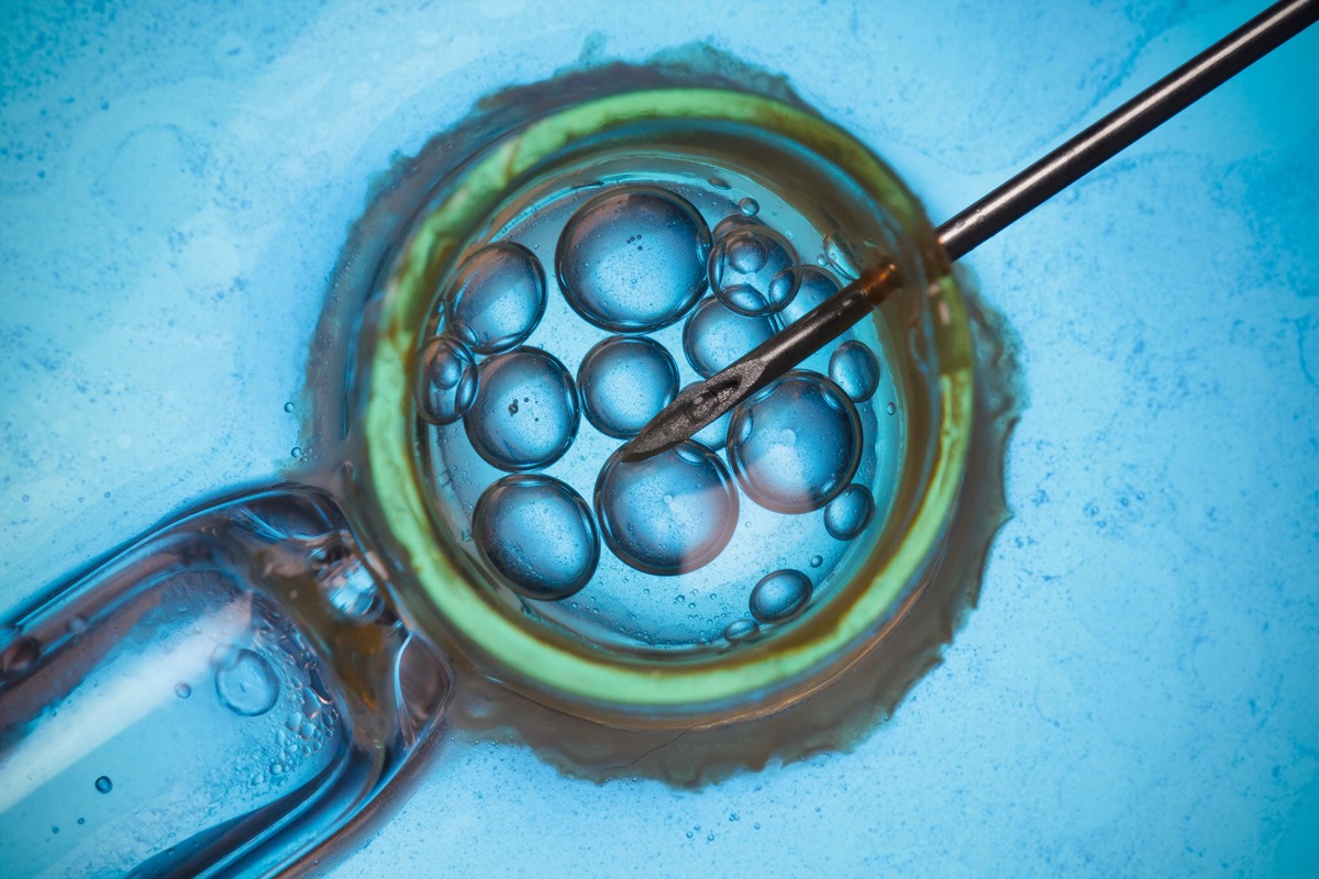 What Is Assisted Reproductive Technology
