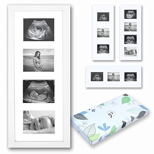White Wooden Baby Sonogram Picture Frame