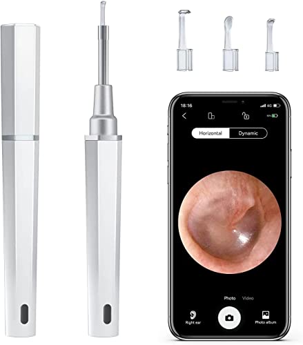 Wireless Earwax Removal Kit with 1080p FHD Camera