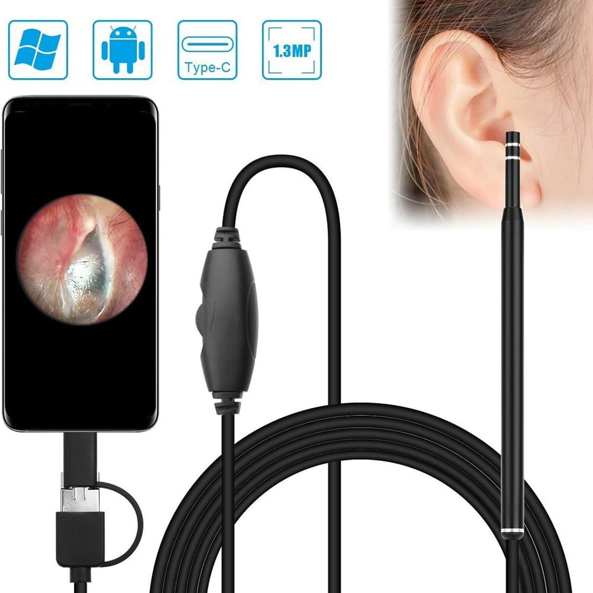 13 Unbelievable Ear Cleaning Endoscope for 2024