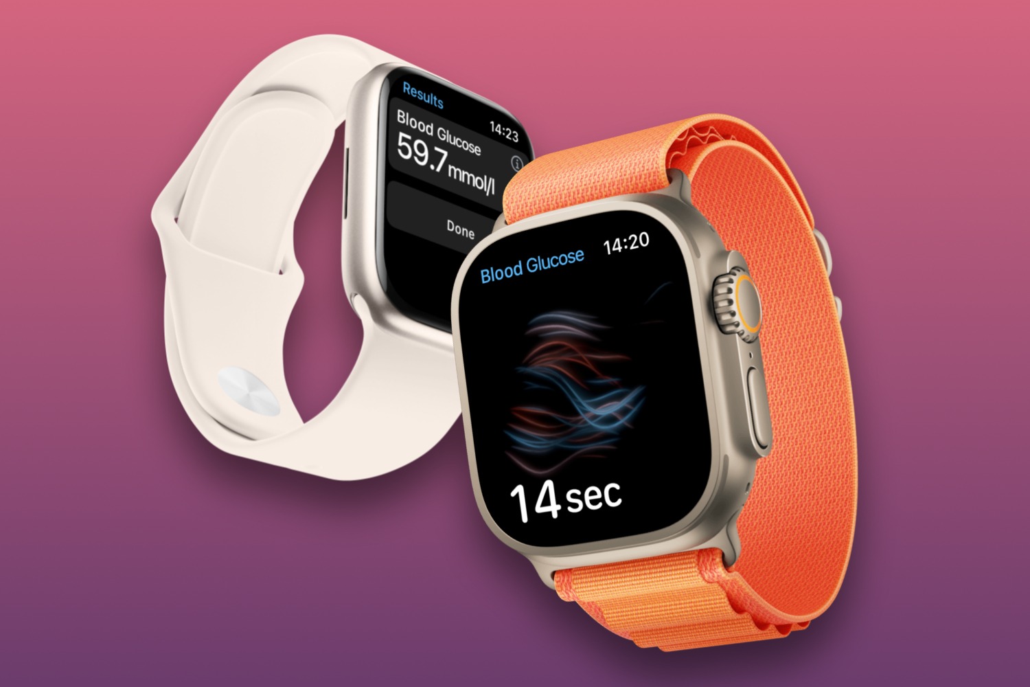 apple-smartwatch-pricing-understanding-the-cost-of-ownership
