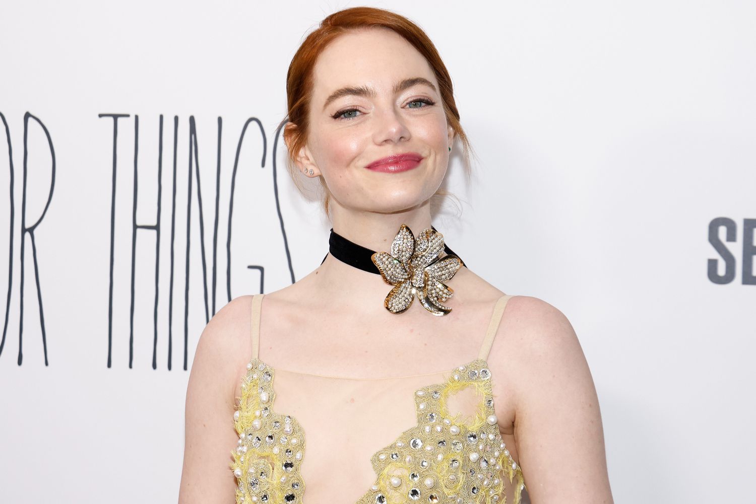 emma-stone-a-timeless-beauty-with-good-genes-or-good-docs