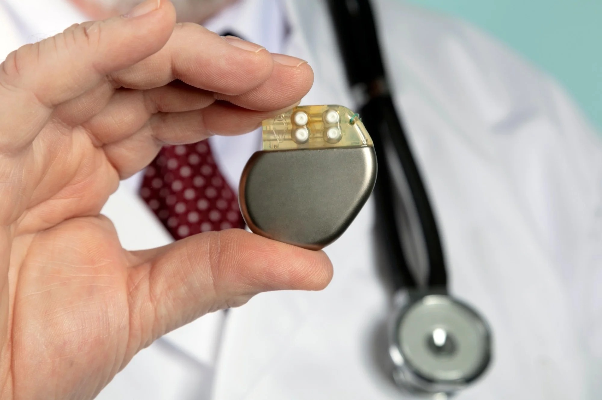 Insights Into Pacemaker Battery Replacement Procedures