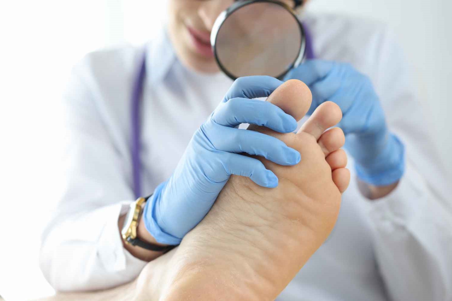 Fungal Therapy: Utilizing Blue Light For Treating Toenail Fungus