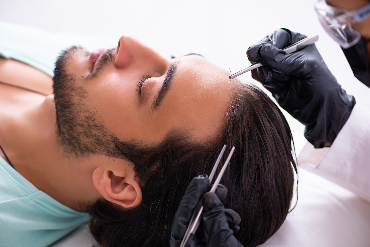How to Book Your Hair Transplant Journey in Turkey