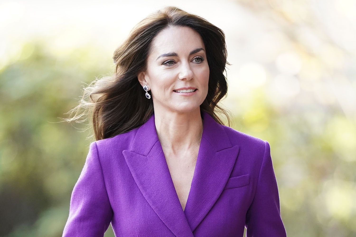 Kate Middleton Undergoes Successful Abdominal Surgery, To Remain Hospitalized For 2 Weeks